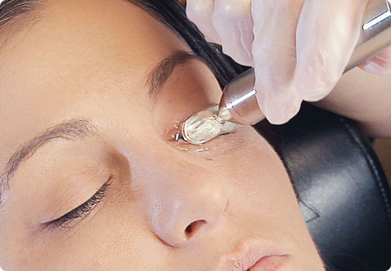 MiBoFlo Thermal Treatment