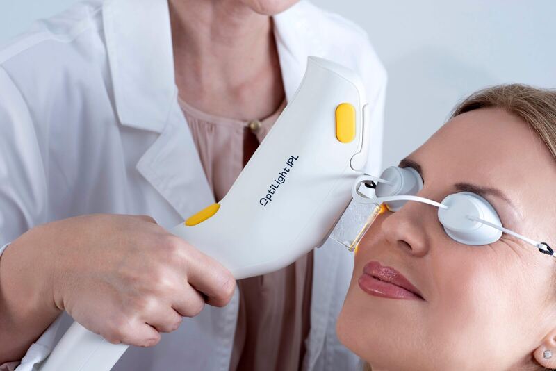 OptiLight IPL Dry Eye Treatment