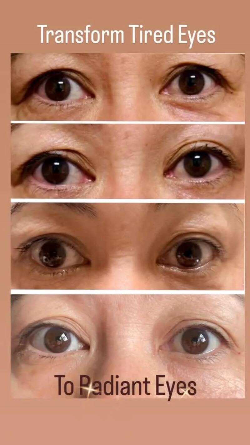 Four before-and-after close-up eye photos shared in an eye wellness post